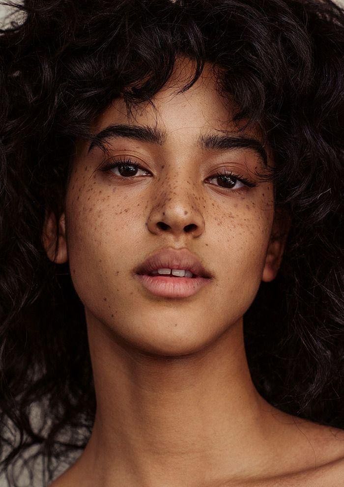 7 Naturopath tips to address dry skin