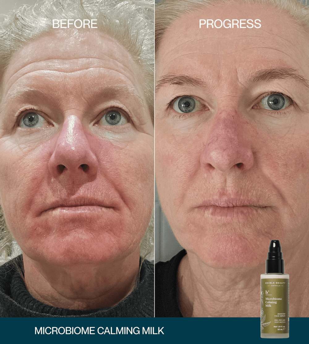 Microbiome Calming Milk Booster Serum