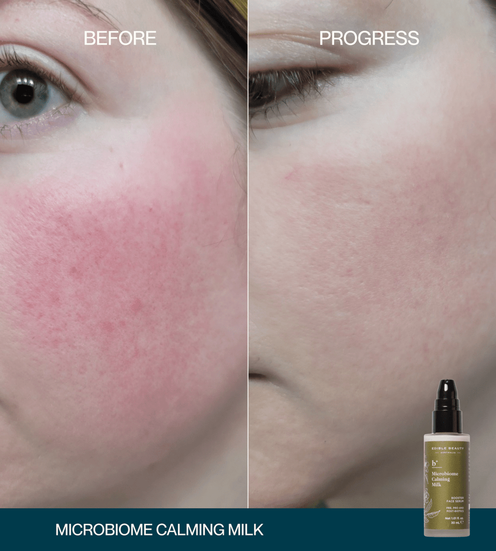 Microbiome Calming Milk Booster Serum