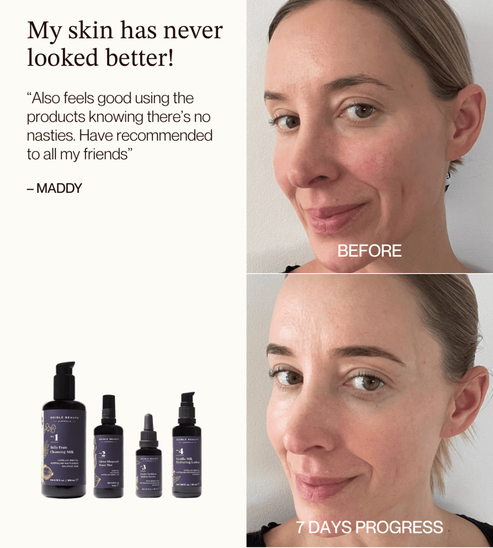 Natural Retinol Alternative Discovery Set