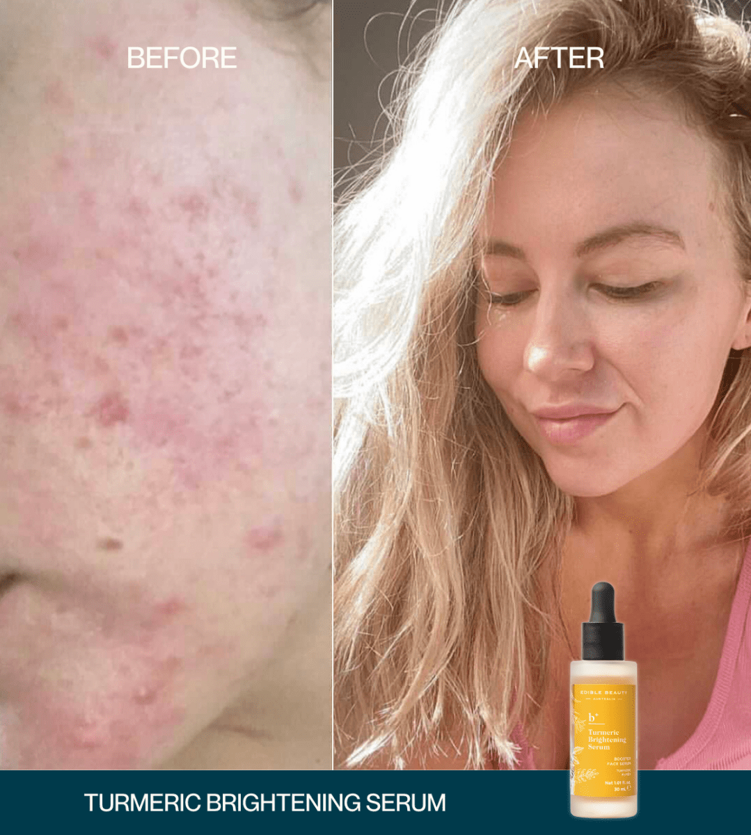 Tumeric Brightner Turmeric Brightening Serum – Clear & Brighten | Edible Beauty Australia
